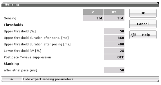 icd_biotronik_sensing7.png