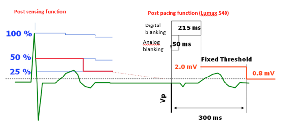 icd_biotronik_sensing8.png