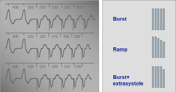 icd_biotronik_therapies3.png