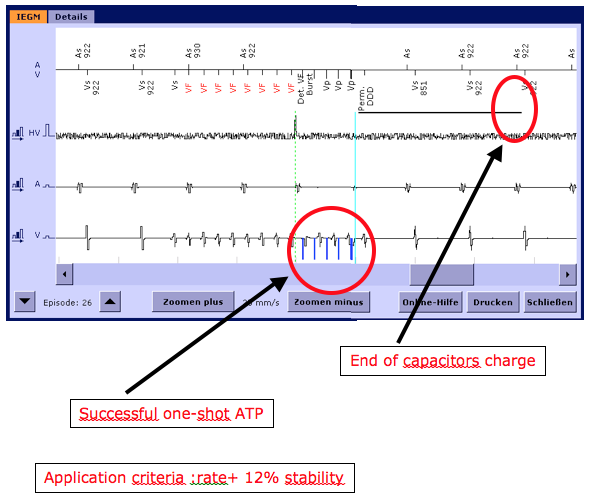 icd_biotronik_therapies6.png