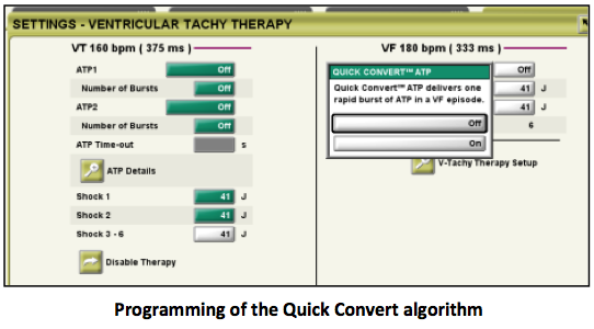 icd_in_20_atp_in_vf_zone_2b.png