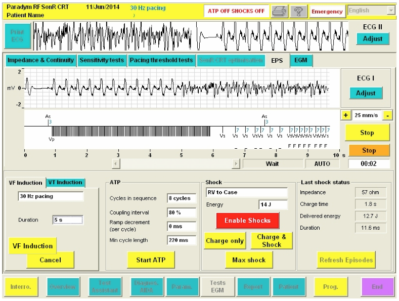 icd_in_20_cs_sorin.png