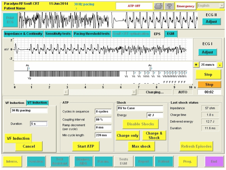 icd_in_20_cs_sorin4.png