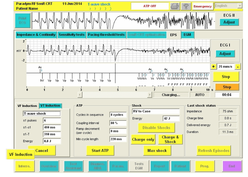 icd_in_20_cs_sorin_1.png