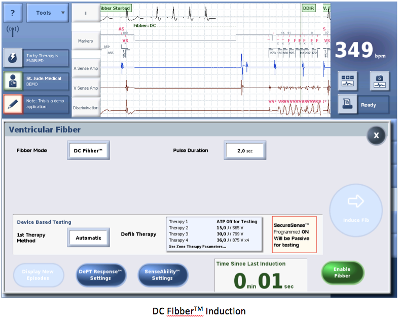 icd_in_20_cs_st_jude1.png