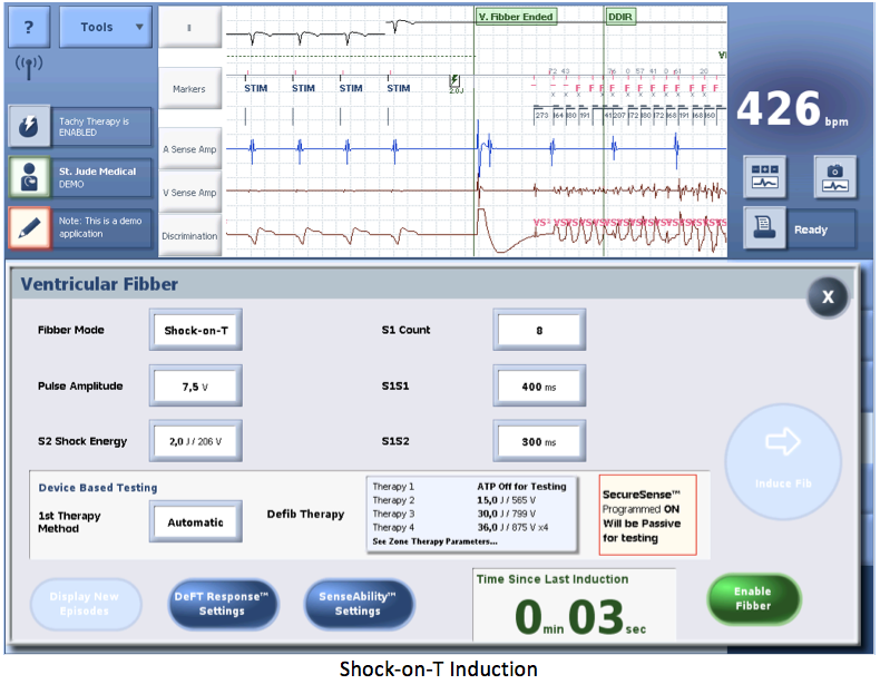 icd_in_20_cs_st_jude2.png