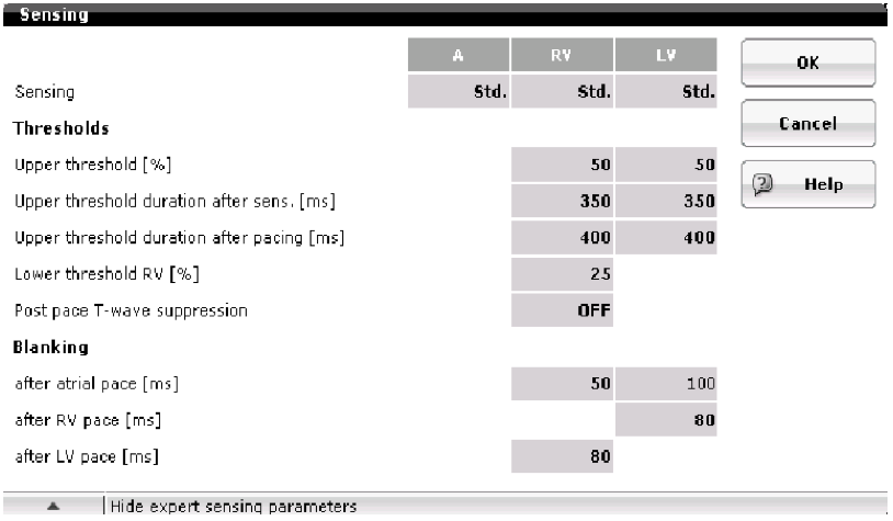 icd_in_20_cs_t_wave_over1.png