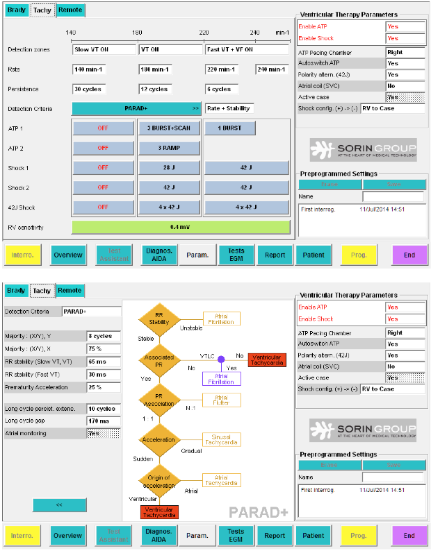 icd_in_20_sorin_discrimination7.png