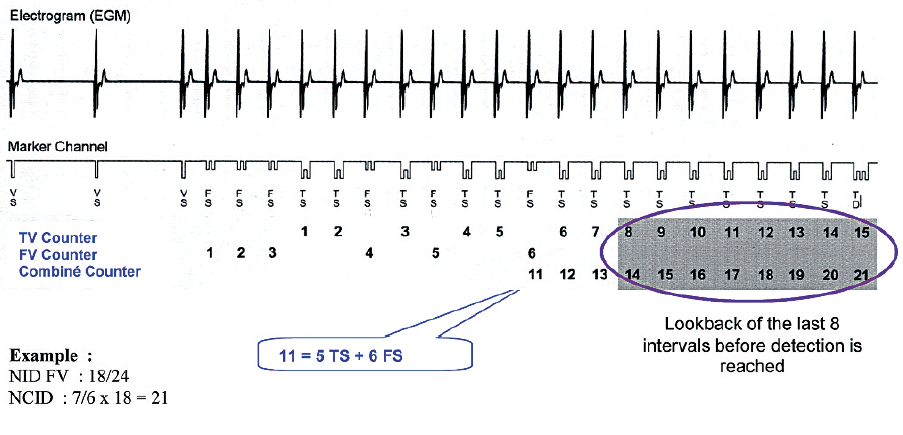 mdtsensing4.png