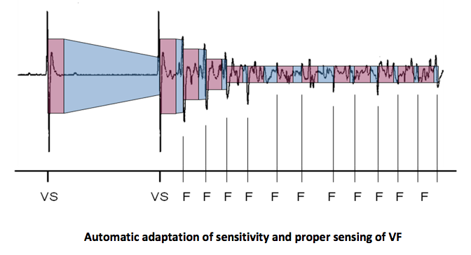 sjm_detection_va3.png