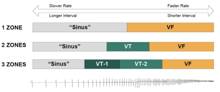 sjm_detection_va6.png