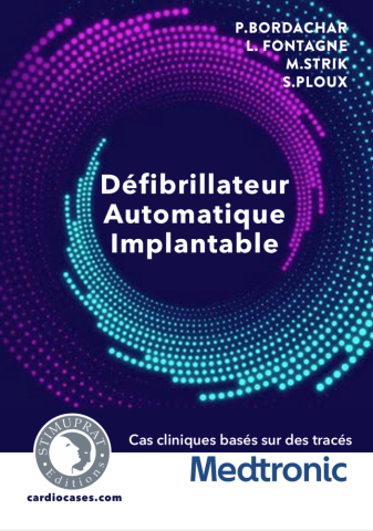 Défibrillateur Automatique Implantable Medtronic Défibrillateur Automatique Implantable Medtronic