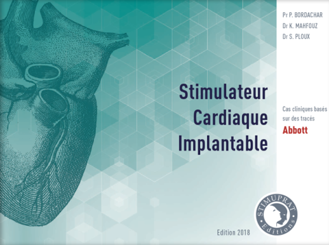 Stimulateur Cardiaque Implantable Abbott Stimulateur Cardiaque Implantable Abbott