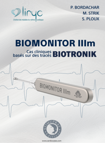 BIOMONITOR IIIm Cas cliniques basés sur des tracés Biotronik