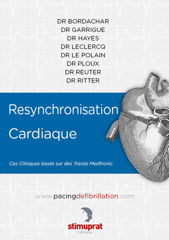 Resynchronisation Cardiaque