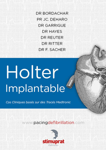 Holter implantable