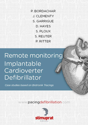 Remote monitoring Implantable Cardioverter Defibrillator