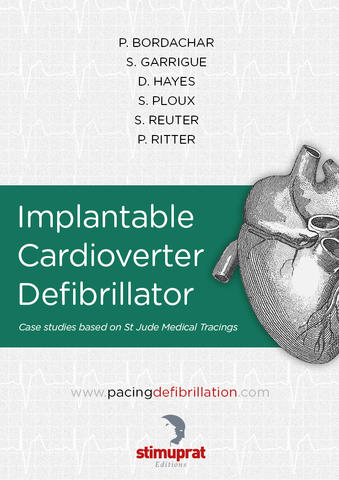 Implantable Cardioverter Defibrillator 