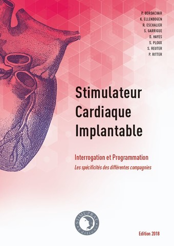 S.E.D.D. Stimulateur cardiaque implantable