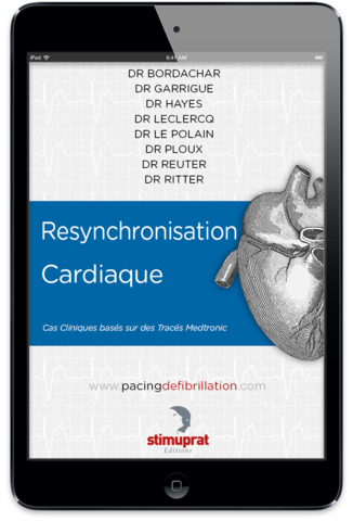 Resynchronisation Cardiaque ebook