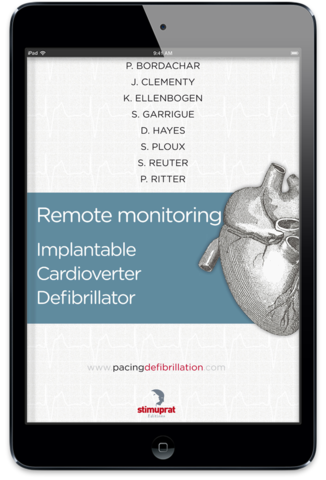 Implantable Cardiac Defibrillator
