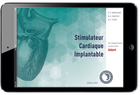 Stimulateur Cardiaque Implantable Abbott