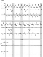 Cardiocases trace PDF