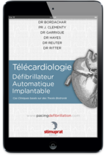 Télécardiologie Défibrillateur Automatique Implantable