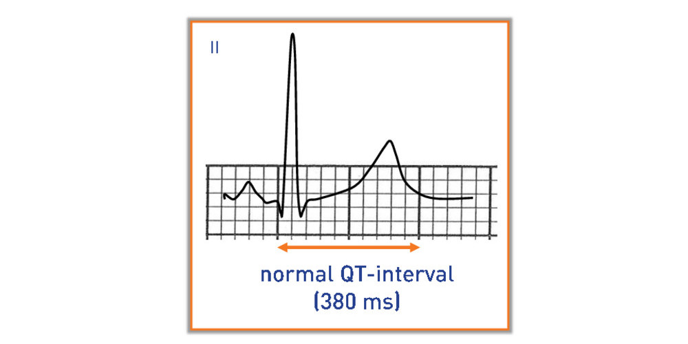 Qt Interval Chart