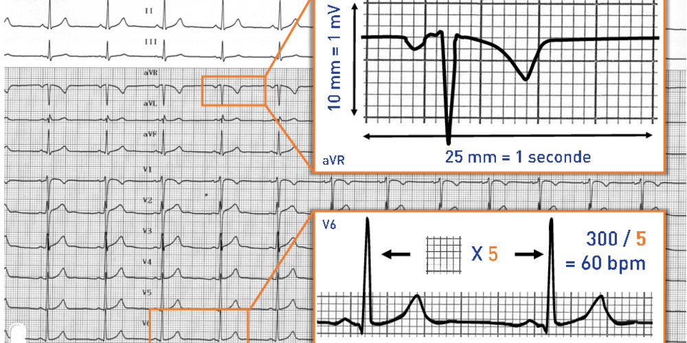 Etalonnage, calibration et calcul de la fréquence cardiaque